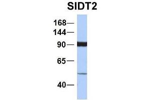 Image no. 5 for anti-SID1 Transmembrane Family, Member 2 (SIDT2) (N-Term) antibody (ABIN2778621)