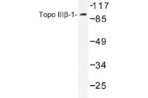 Image no. 1 for anti-Topoisomerase (DNA) III beta (TOP3B) antibody (ABIN272153)