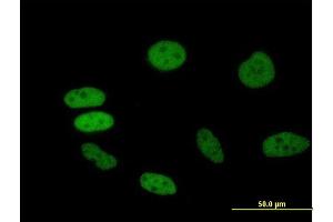 Image no. 1 for anti-Bromodomain Containing 2 (BRD2) (AA 1-801) antibody (ABIN948411)