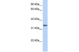 Image no. 1 for anti-RAB40A, Member RAS Oncogene Family (RAB40A) (Middle Region) antibody (ABIN634428)