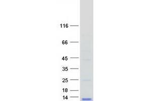 Image no. 1 for Chemokine (C-C Motif) Ligand 3-Like 1 (CCL3L1) protein (Myc-DYKDDDDK Tag) (ABIN2724560)