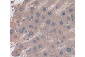 Image no. 2 for anti-Leukocyte Cell-Derived Chemotaxin 2 (LECT2) (AA 1-151) antibody (ABIN1859639)