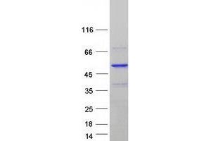 Image no. 1 for Polymerase (DNA-Directed), delta Interacting Protein 3 (POLDIP3) (Transcript Variant 1) protein (Myc-DYKDDDDK Tag) (ABIN2729304)