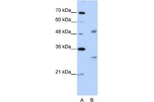 Image no. 1 for anti-Eukaryotic Translation Initiation Factor 4H (EIF4H) (Middle Region) antibody (ABIN2776554)