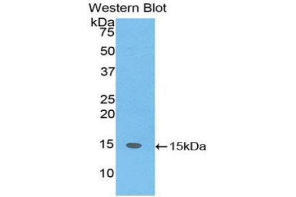SH2D1A anticorps  (AA 18-115)