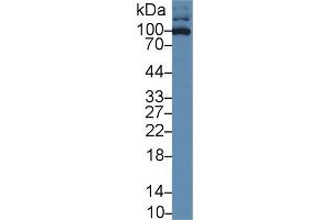 Image no. 2 for anti-Intercellular Adhesion Molecule 3 (ICAM3) (AA 46-197) antibody (ABIN5013759)