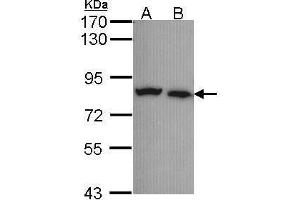 Image no. 1 for anti-Calpain 5 (CAPN5) (Center) antibody (ABIN2855597)