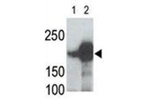 Image no. 3 for anti-Low Density Lipoprotein Receptor-Related Protein 5 (LRP5) (AA 1538-1567) antibody (ABIN3031641)