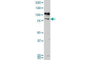 Image no. 1 for anti-NIMA-Related Kinase 5 (NEK5) (AA 601-708) antibody (ABIN531657)
