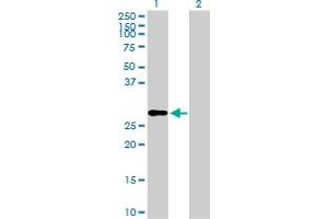 Image no. 1 for anti-Insulin-Like Growth Factor 2 (IGF2) (AA 1-180) antibody (ABIN516941)