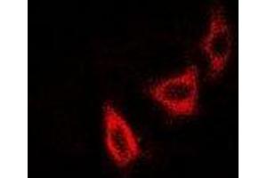 Image no. 1 for anti-NudE Neurodevelopment Protein 1 (NDE1) antibody (ABIN3197744)
