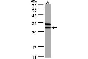 Image no. 3 for anti-Electron-Transfer-Flavoprotein, beta Polypeptide (ETFB) (Center) antibody (ABIN2856657)