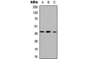 Image no. 1 for anti-Abhydrolase Domain Containing 13 (ABHD13) (Center) antibody (ABIN2705378)