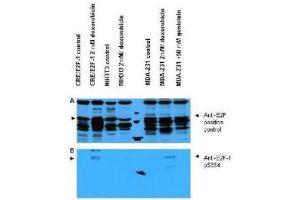 Western blot using  Affinity Purified anti-E2F-1 pS364 antibody shows detection of a band at ~47 kDa corresponding to phosphorylated E2F-1 in induced cell lysates.