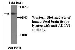 Image no. 1 for anti-Adenylate Cyclase 2 (Brain) (ADCY2) antibody (ABIN6583494)