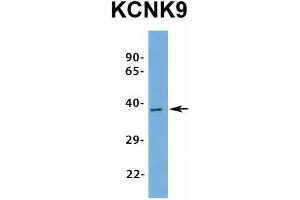 Image no. 5 for anti-Potassium Channel, Subfamily K, Member 9 (KCNK9) (N-Term) antibody (ABIN2776216)