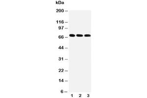 Image no. 2 for anti-Interleukin-1 Receptor-Associated Kinase 3 (IRAK3) (C-Term) antibody (ABIN3031495)