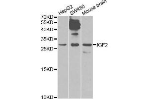 Image no. 1 for anti-Insulin-Like Growth Factor 2 (IGF2) antibody (ABIN3022873)