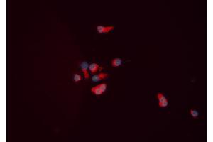 Image no. 1 for anti-Neuropeptide Y Receptor Y5 (NPY5R) antibody (ABIN6257375)
