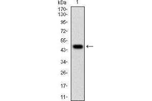 Image no. 2 for anti-Wilms Tumor 1 (WT1) (AA 314-479) antibody (ABIN5684073)