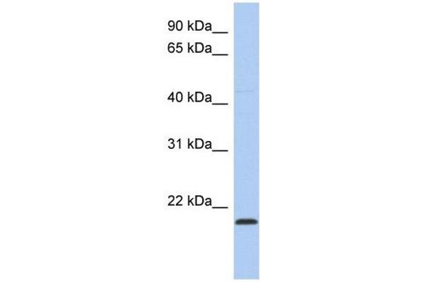 anti-RWD Domain Containing 4 (RWDD4) (Middle Region) antibody