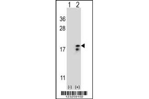 Western Blotting (WB) image for anti-Cytochrome C Oxidase Subunit VIa Polypeptide 1 (COX6A1) antibody (ABIN2158340)