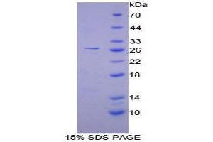 Image no. 1 for Calcium/calmodulin-Dependent Protein Kinase II gamma (CAMK2G) (AA 6-208) protein (His tag) (ABIN1879728)