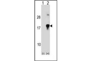 Image no. 1 for anti-High Mobility Group Nucleosomal Binding Domain 3 (HMGN3) (AA 1-30), (N-Term) antibody (ABIN952763)
