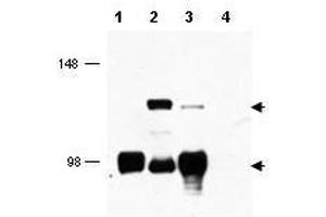 Western blot using  affinity purified anti-MECT1 antibody shows detection of endogenous MECT1 (lower arrowhead) and MECT1-MAML2 fusion protein (top arrowhead) in cell lysates.