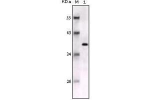 Image no. 3 for anti-S100 Calcium Binding Protein B (S100B) antibody (ABIN969391)