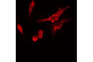 Image no. 2 for anti-Ribosomal Protein S11 (RPS11) (C-Term) antibody (ABIN6257640)