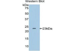 VEGFB 抗体  (AA 22-207)