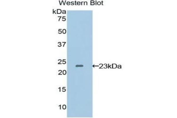 VEGFB anticorps  (AA 22-207)