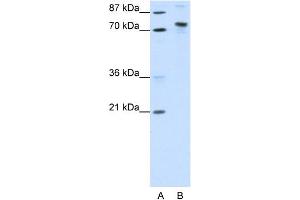 Image no. 1 for anti-TOX High Mobility Group Box Family Member 4 (TOX4) (N-Term) antibody (ABIN2780949)