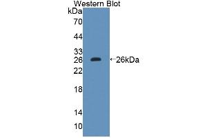 Image no. 1 for anti-Cytochrome P450, Family 11, Subfamily A, Polypeptide 1 (CYP11A1) (AA 329-526) antibody (ABIN5013425)