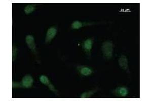 Image no. 1 for anti-F-Box Protein, Helicase, 18 (FBXO18) antibody (ABIN931163)