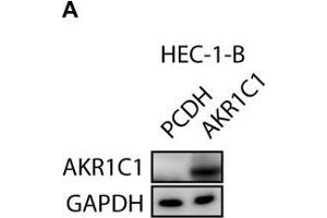 Image no. 6 for anti-Dihydrodiol Dehydrogenase (DDH) (Center) antibody (ABIN2856139)