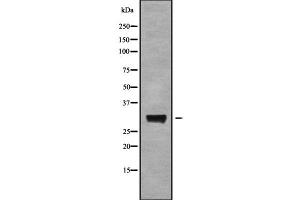Image no. 2 for anti-Aquaporin 6, Kidney Specific (AQP6) (Internal Region) antibody (ABIN6260012)