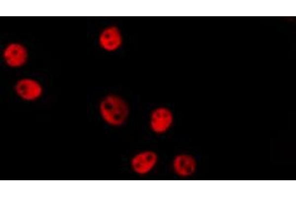anti-High Mobility Group Nucleosomal Binding Domain 2 (HMGN2) (Internal Region) antibody