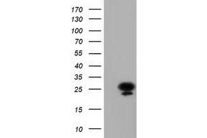 Image no. 1 for anti-Adenylate Kinase 3 (AK3) antibody (ABIN1496523)