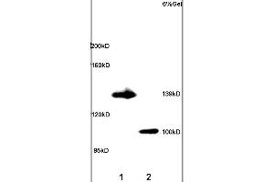 Image no. 1 for anti-Adenylate Cyclase 5 (ADCY5) (AA 857-909) antibody (ABIN751183)