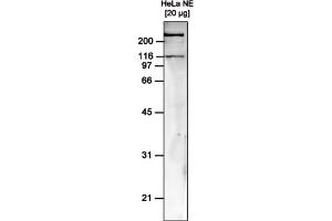 Image no. 1 for anti-SWI/SNF Related, Matrix Associated, Actin Dependent Regulator of Chromatin, Subfamily A, Member 5 (SMARCA5) antibody (ABIN6655221)