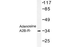 Image no. 1 for anti-Adenosine A2b Receptor (ADORA2B) antibody (ABIN317695)