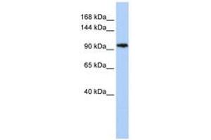Image no. 1 for anti-Chromosome 11open Reading Frame 9 (C11orf9) (AA 108-157) antibody (ABIN6742471)