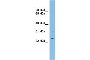 Image no. 2 for anti-Ubiquitin-Conjugating Enzyme E2E 3 (UBE2E3) (N-Term) antibody (ABIN2774921)