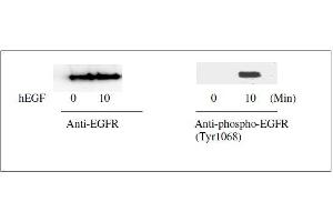Image no. 10 for Epidermal Growth Factor Receptor (EGFR) ELISA Kit (ABIN1981829)