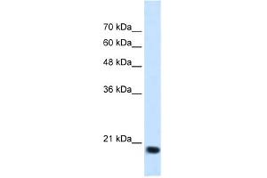 Image no. 1 for anti-Signal Sequence Receptor, beta (Translocon-Associated Protein Beta) (SSR2) (N-Term) antibody (ABIN2782213)