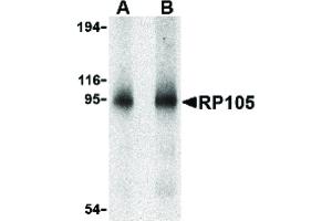 Image no. 1 for anti-CD180 Molecule (CD180) (N-Term) antibody (ABIN6655463)