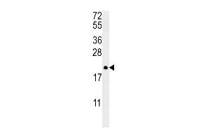 Image no. 1 for anti-Protein tyrosine Phosphatase Type IVA, Member 2 (PTP4A2) (Center) antibody (ABIN2495670)
