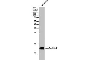 Image no. 4 for anti-Profilin 2 (PFN2) (Center) antibody (ABIN2856620)